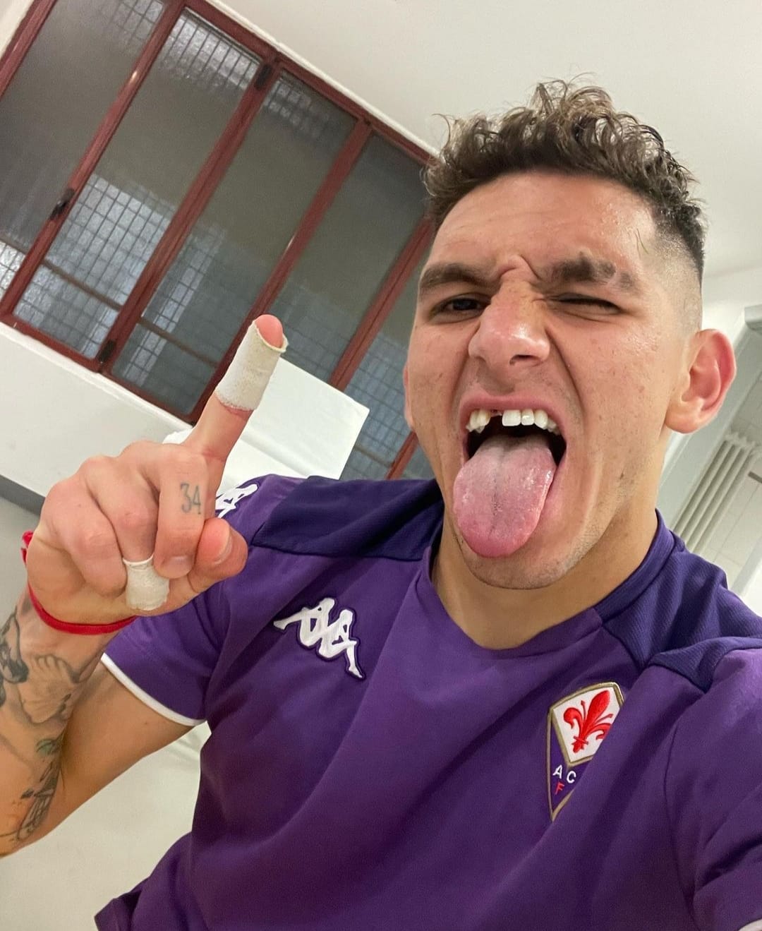 Torreira guerriero viola, perde il dente durante la partita contro l'Inter e nello spogliatoio se la ride