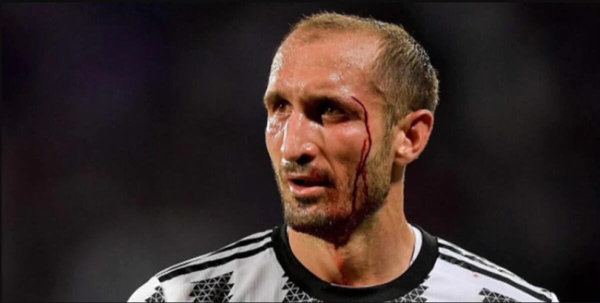 La brutta gara contro la Fiorentina è stata l'ultima di Chiellini in Italia, il difensore andrà al Los Angeles - 