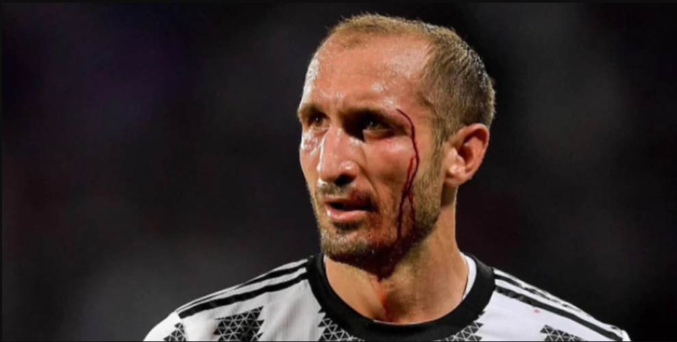 Il rimpianto di Chiellini: "Non avessi lasciato la Fiorentina avrei vinto il mondiale con la nazionale"