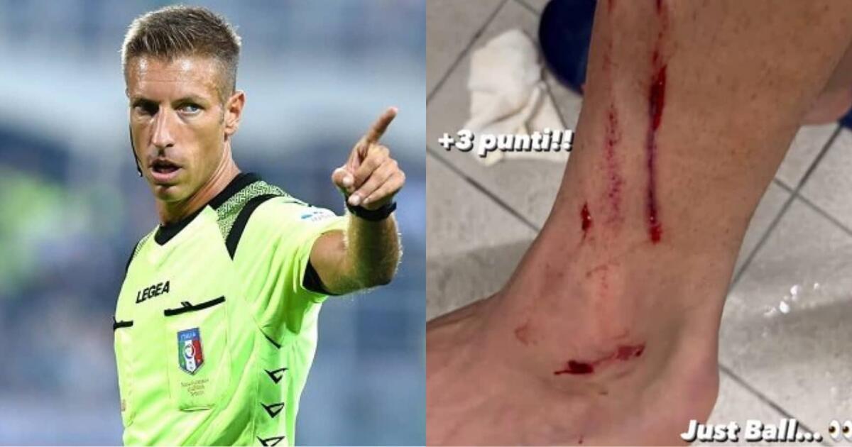 Il Tirreno demolisce Massa: "Scambia calcio all’inglese per calcio storico, fischia e ammonisce a caso" - 