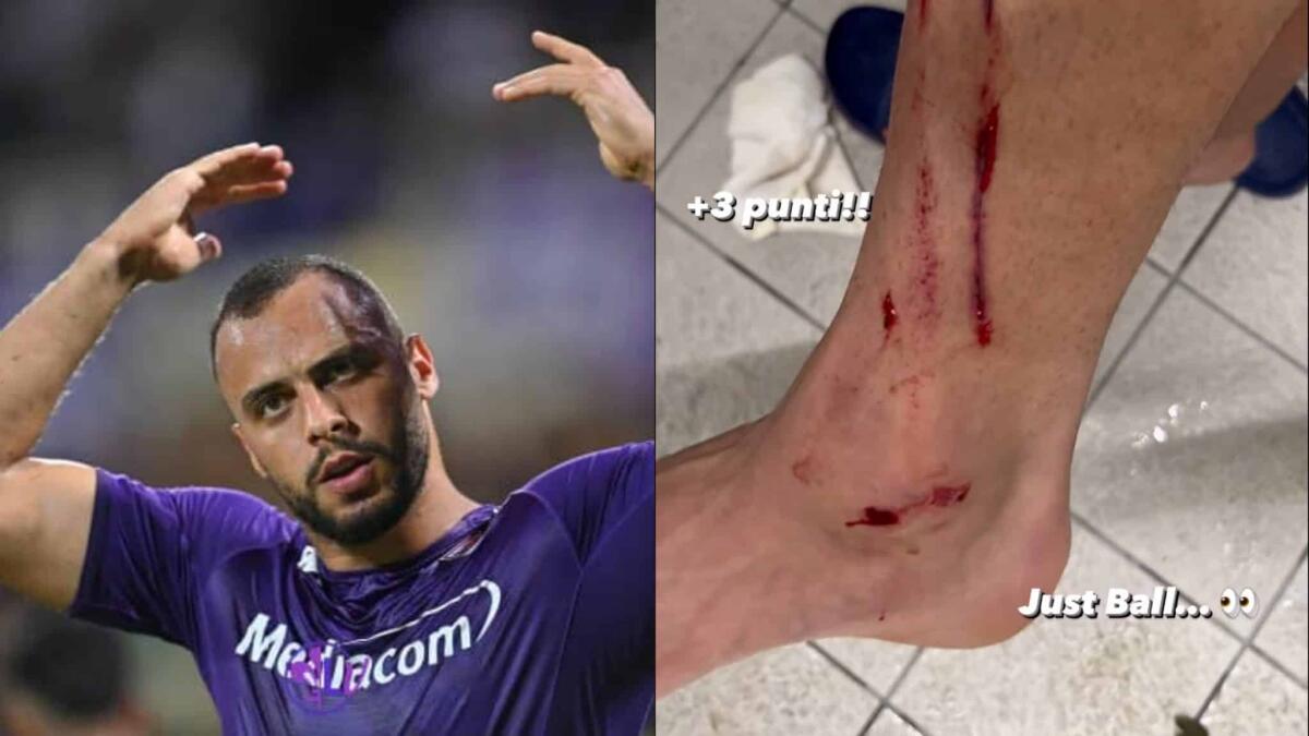 Cabral sui social mostra i segni lasciati dall'entrata di Nikolaou, espulso dopo l'OFR: "Solo palla..." - 
