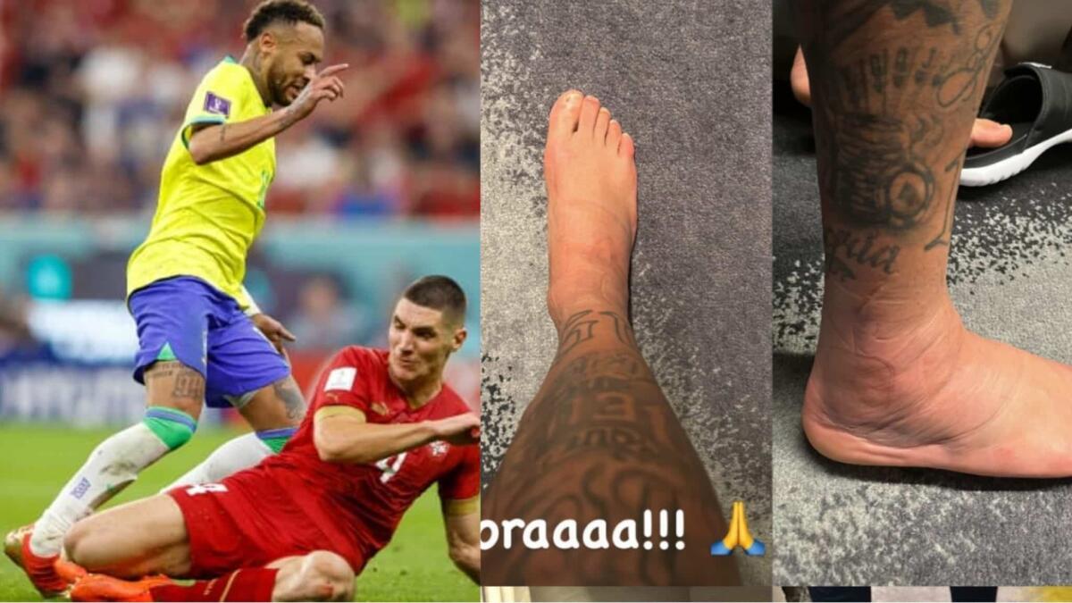 Neymar non ha ancora superato lo scontro con Milenkovic, mostra su Instagram la caviglia gonfia - 