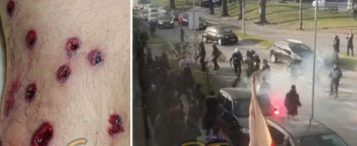 Testimonianze tifosi Fiorentina feriti dopo gli scontri in Portogallo: “Qua sparano e arrestano” - 