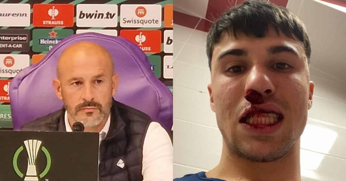 Italiano infuriato: "Bianco ha il naso rotto, è vergognoso. Colpito mentre non se lo aspettava" - 