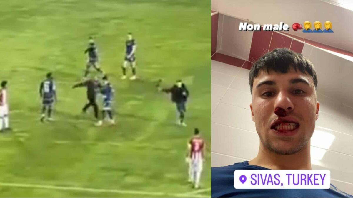 Il video dell'aggressione subita da Bianco. Pugno in pieno volto dal tifoso e naso rotto in campo - 