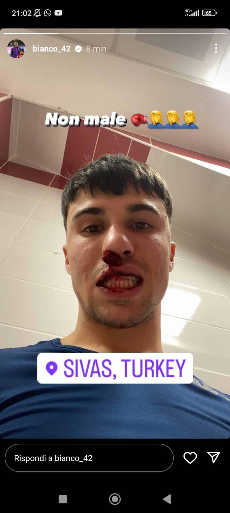 Vergogna in Turchia, un tifoso del Sivasspor entra in campo e tira un pugno a Bianco