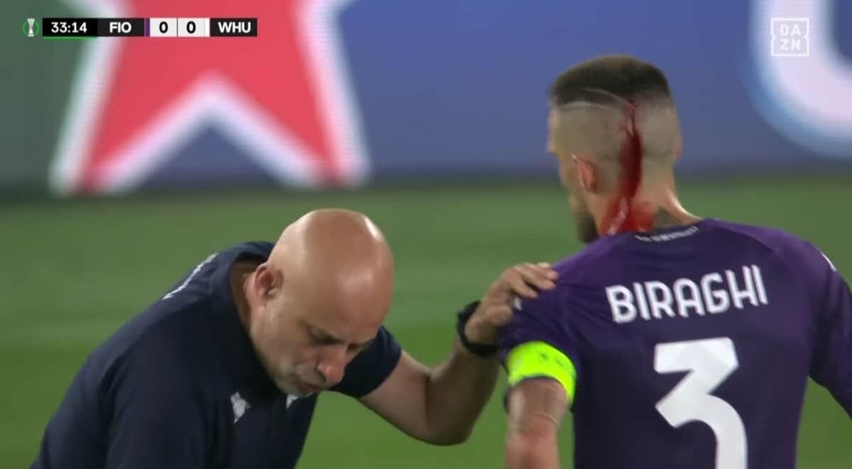 Poche possibilità che la Fiorentina vinca a tavolino per la testa rotta a Biraghi. Se fosse rimasto a terra... - 