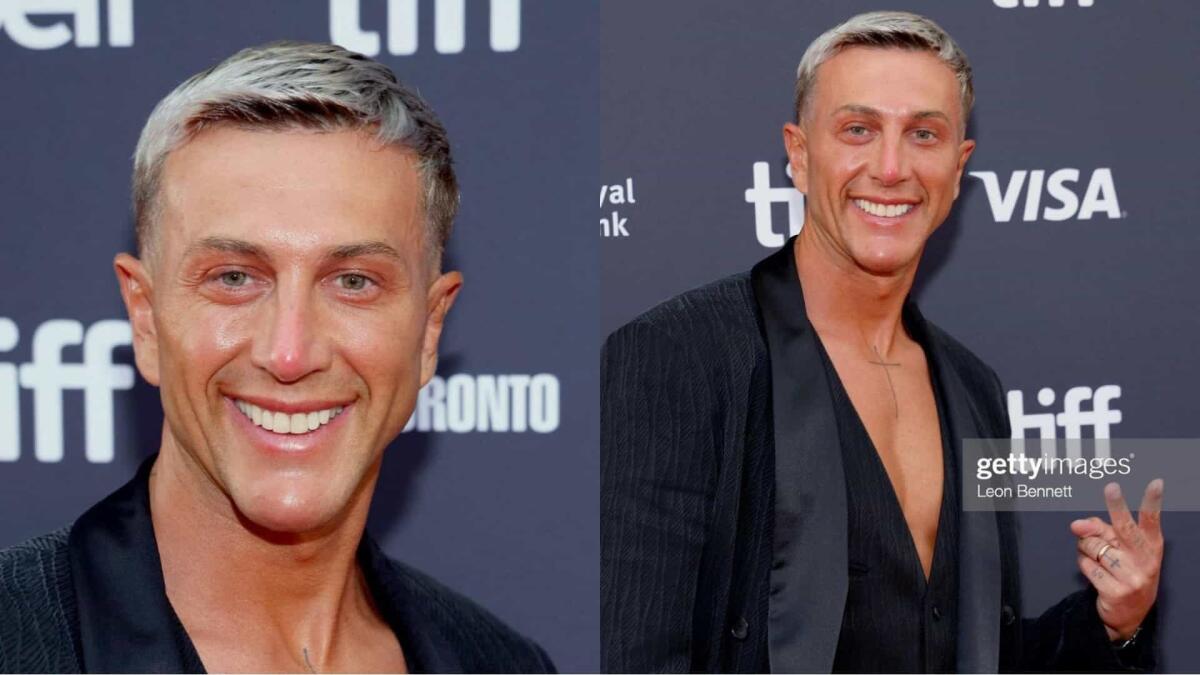 Truccato e con il mento rifatto. Bernardeschi si mostra con il suo nuovo look e la gente si interroga - 