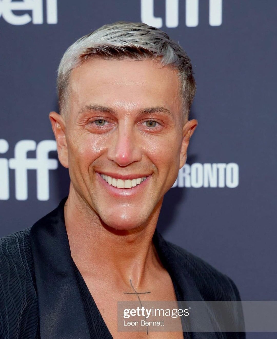 Truccato e con il mento rifatto. Bernardeschi si mostra con il suo nuovo look e la gente si interroga