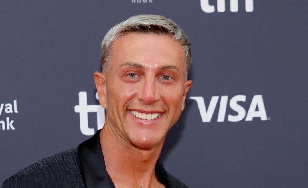Truccato e con il mento rifatto. Bernardeschi si mostra con il suo nuovo look e la gente si interroga