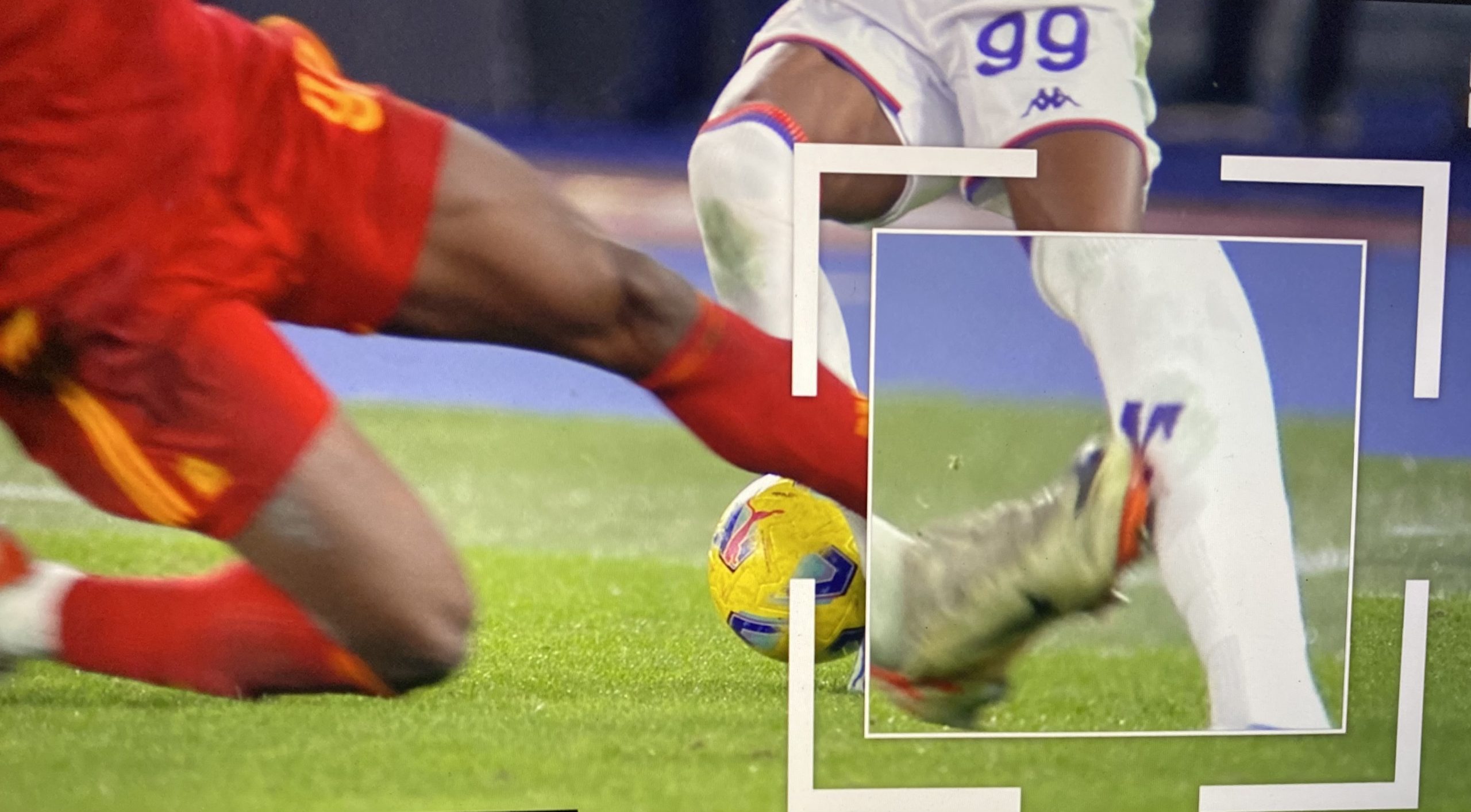 Kouamè mostra le condizioni della sua gambe dopo il fallo killer di Lukaku che gli poteva costare caro