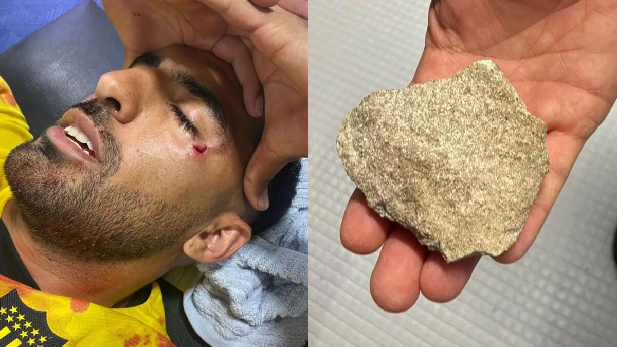 Maxi Olivera colpito al volto da una pietra in Uruguay, esce dal campo con il viso coperto di sangue - 