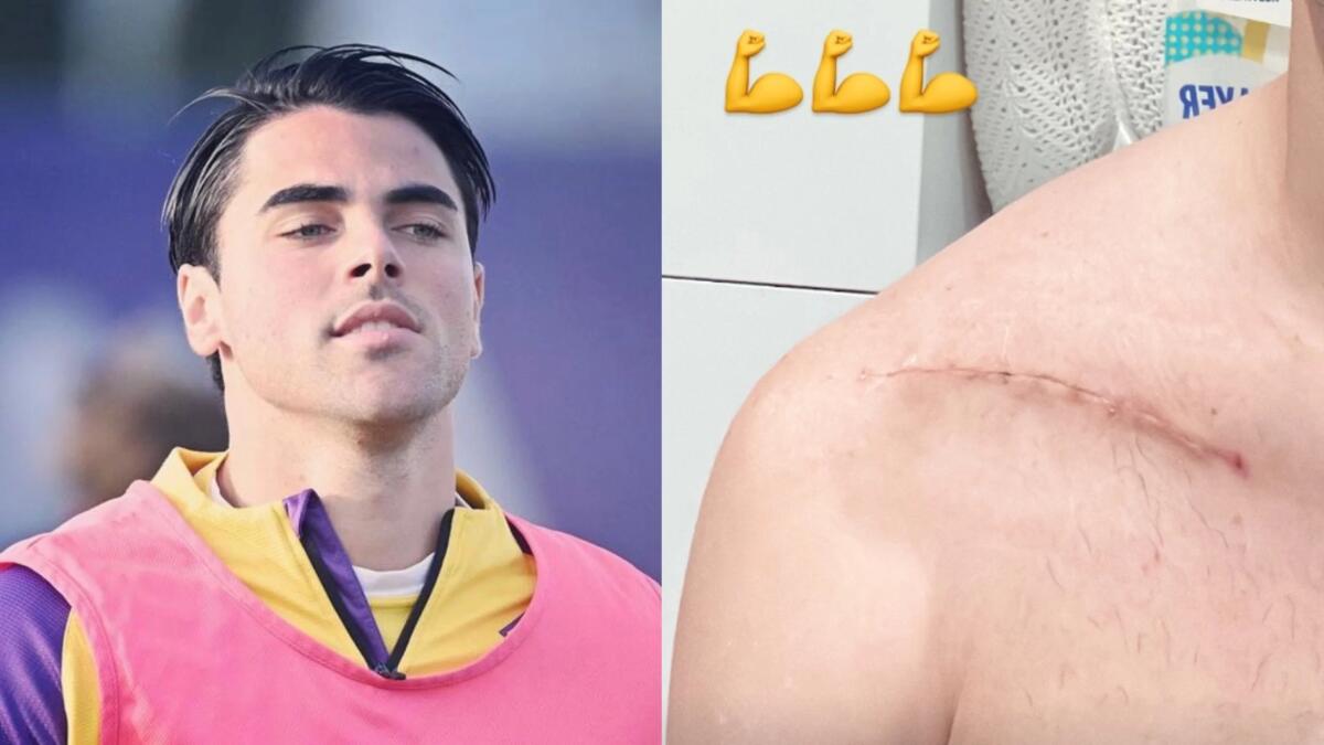 Sottil è tornato ad allenarsi al Viola Park e mostra i segni dell'operazione alla spalla. La foto - Foto: Instagram Sottil