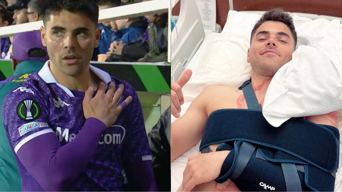 FOTO, Sottil si è operato alla spalla sinistra, sorridente dopo l'operazione in ospedale - 