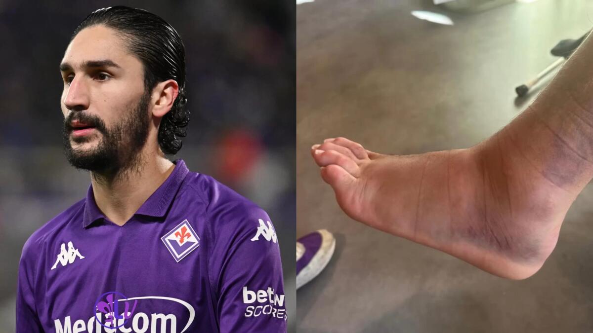 Adli festeggia sui social il ritorno in campo e pubblica una foto della caviglia a cui si era fatto male - 