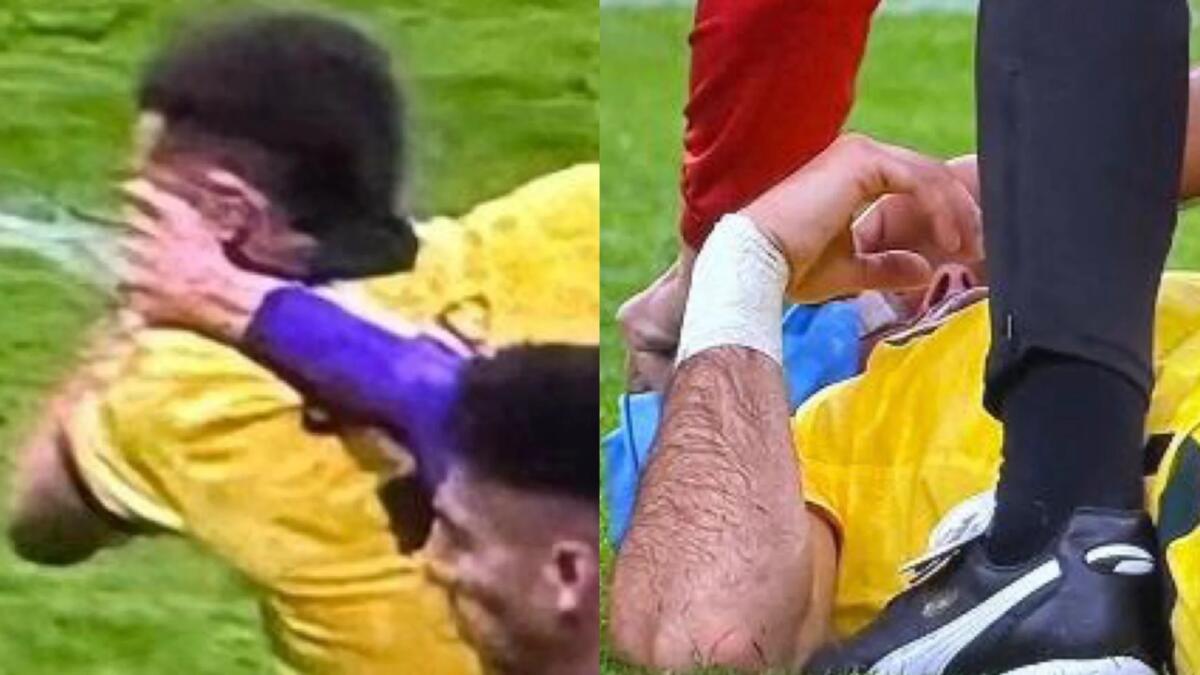 Nazione: “Gimenez, che furbata! Mano sul volto a sinistra e ghiaccio messo a destra” - 