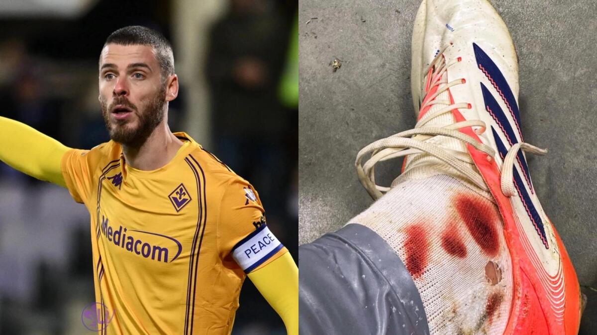 Lo scontro con Pulisic lascia il segno: De Gea mostra la caviglia sanguinante sui social - 